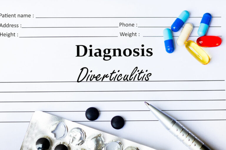 Things to Know about Diverticulitis