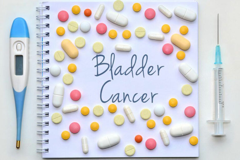 Things to know about the different stages of bladder cancer