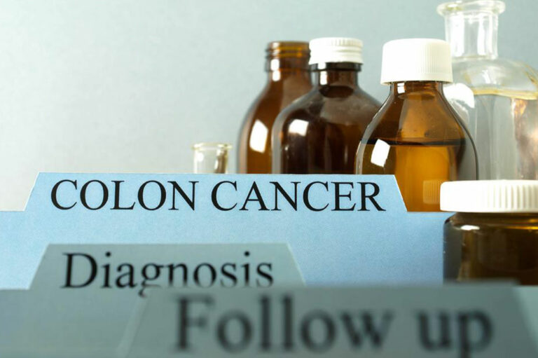 Things you need to know about colon cancer