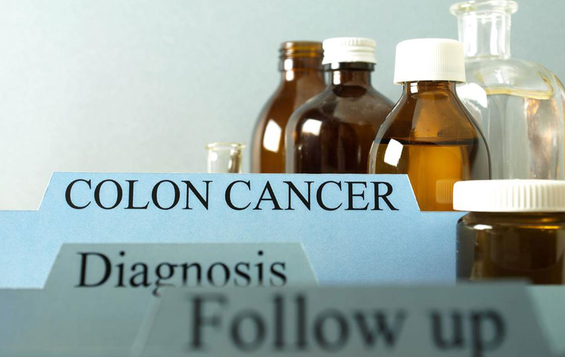 Things you need to know about colon cancer