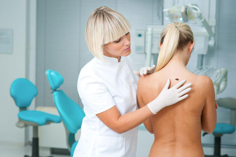 Things you should know about stage four melanoma