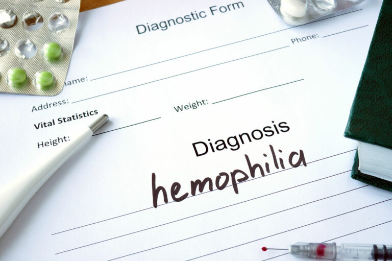 Three Factors to Consider While Living with Hemophilia