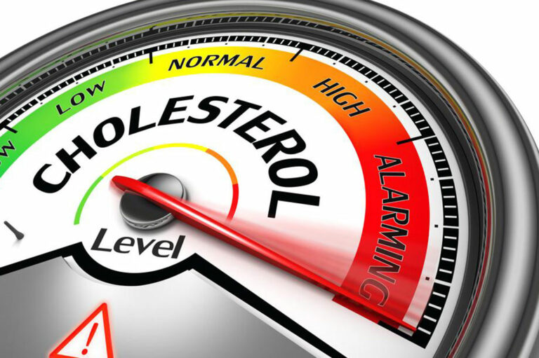 Tips to Manage Your Cholesterol Levels