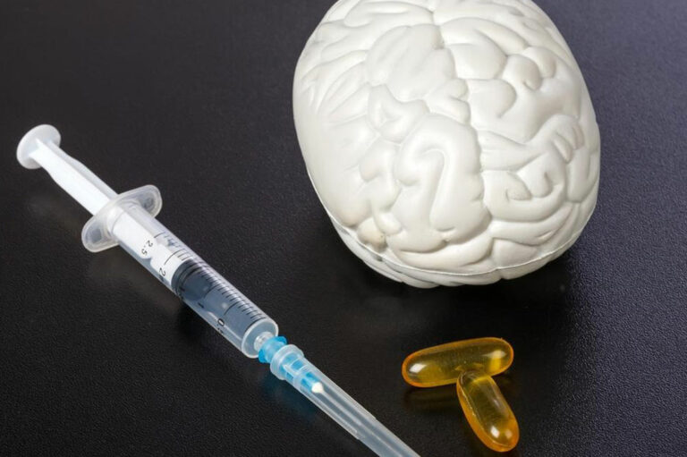 Top 10 Brain Supplements to Enhance Brain Functionality