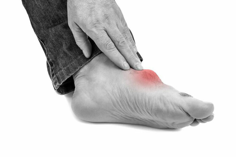 Top triggers for gout foot pain