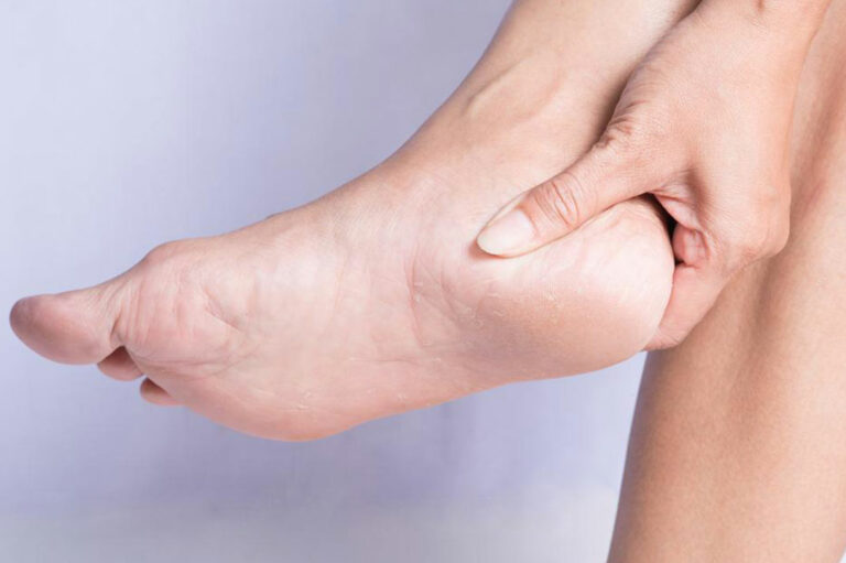 Treatment for Heel Pain: Relief from Severe Heel Pain