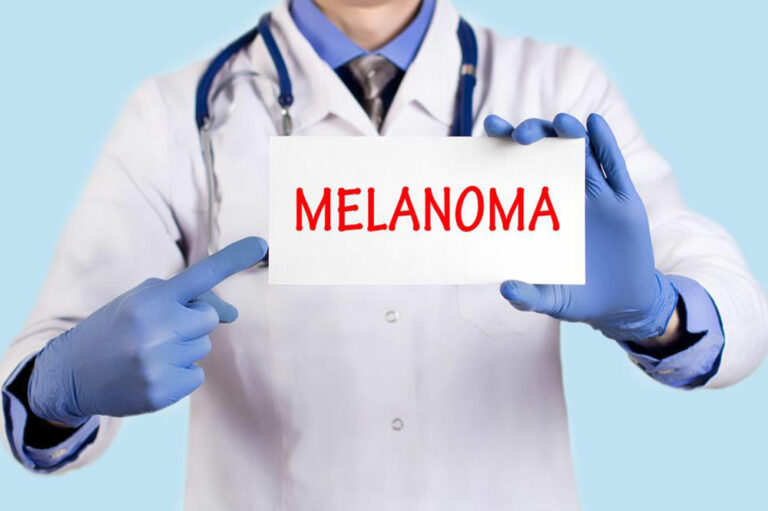 Understanding metastatic malignant melanoma