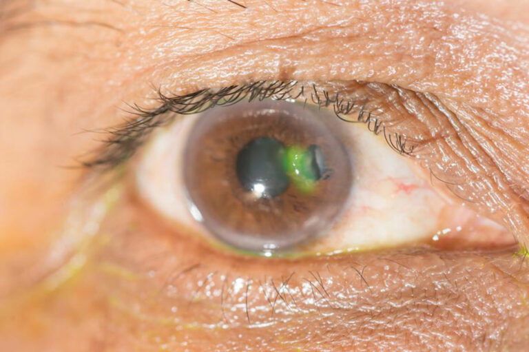 Various eye diseases and their symptoms