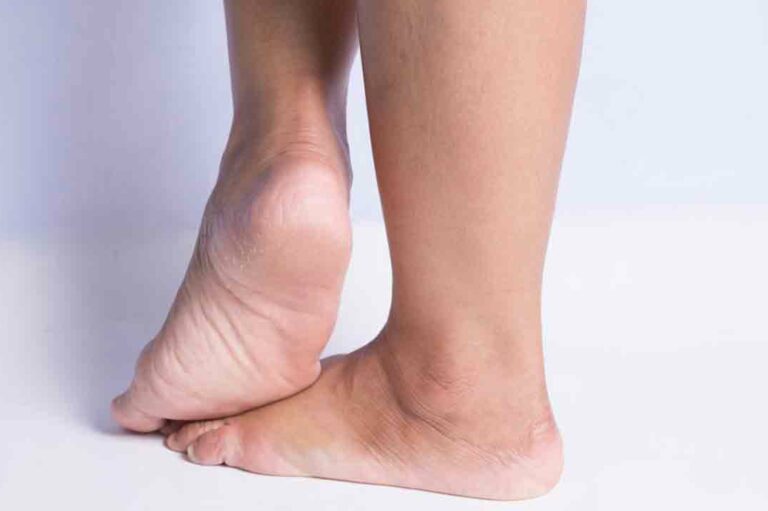 Walk In Stride By Treating Heel Pain