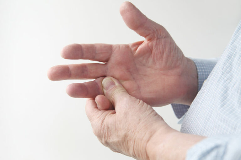 Ways to manage and avoid rheumatoid arthritis