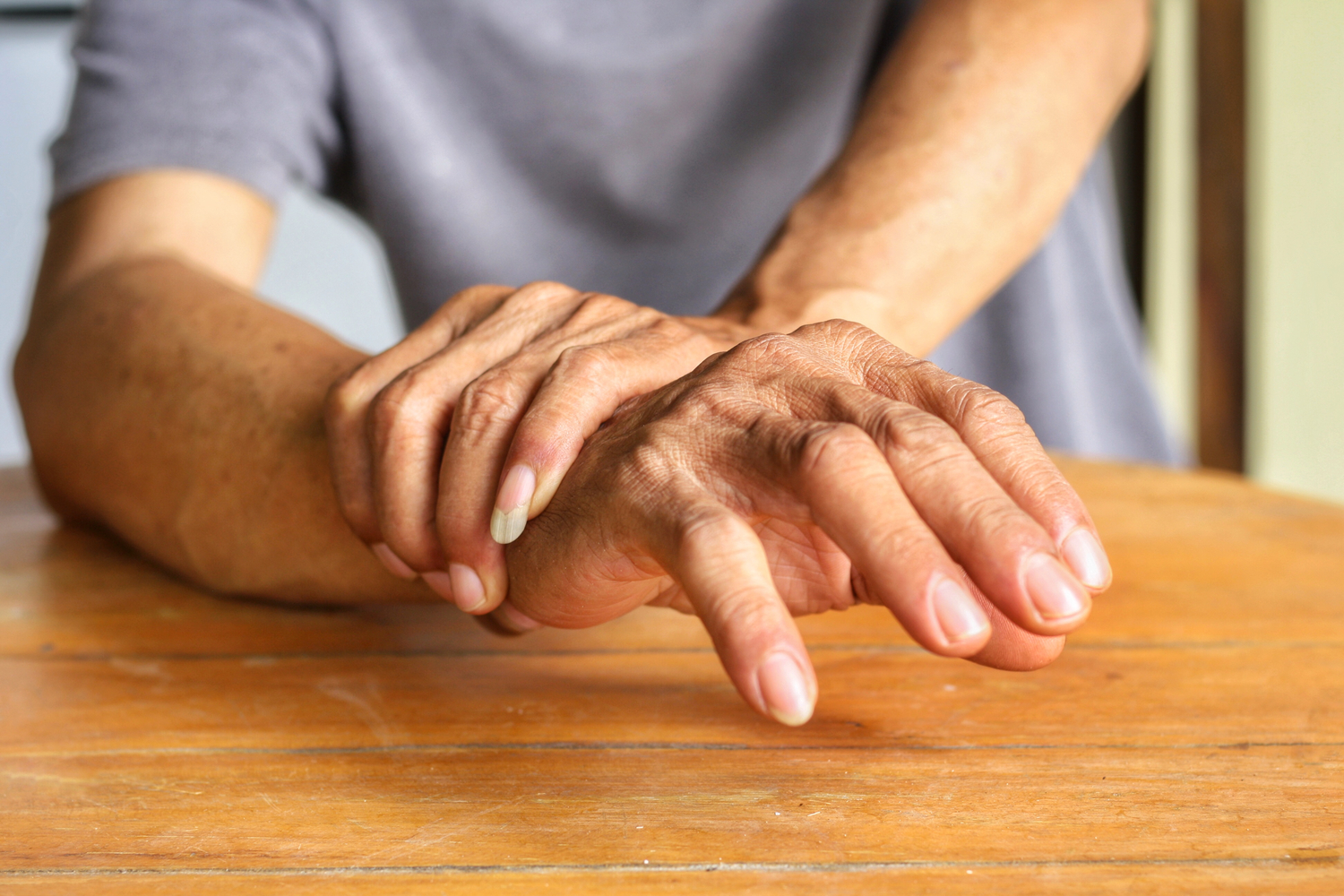 Ways To Manage Psoriatic Arthritis With Lifestyle Changes