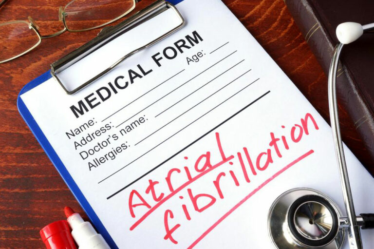 What you should do for AFib treatment