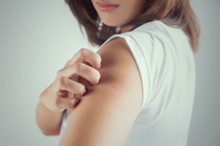 10 Reasons Why You Get Hives