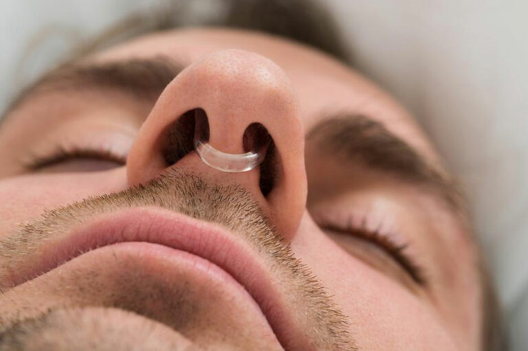 10 Things You Need to Know about Anti Snoring Devices