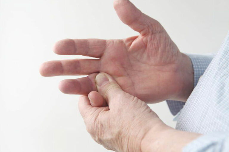 3 common causes of rheumatoid arthritis