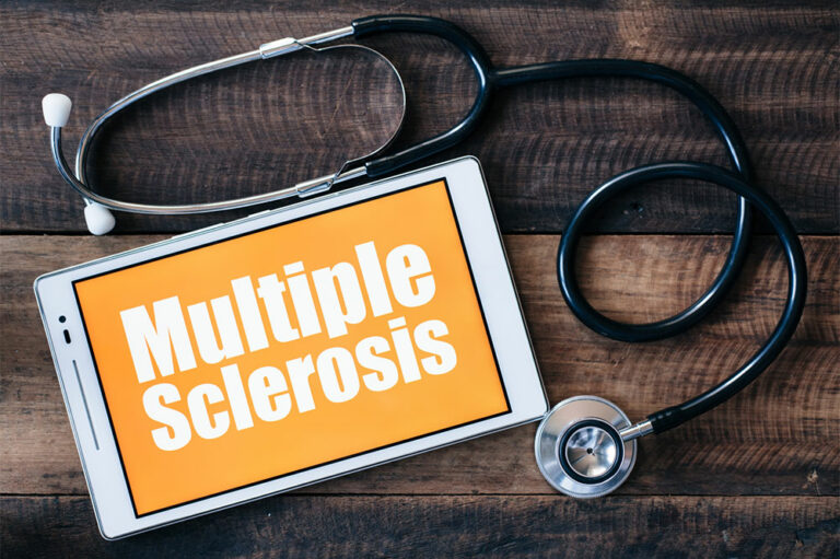 5 common treatments for multiple sclerosis