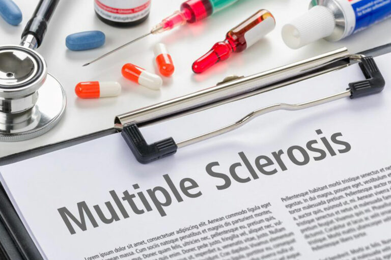 5 common symptoms of multiple sclerosis