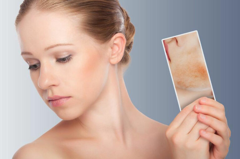 6 things you should not do if you have skin rash