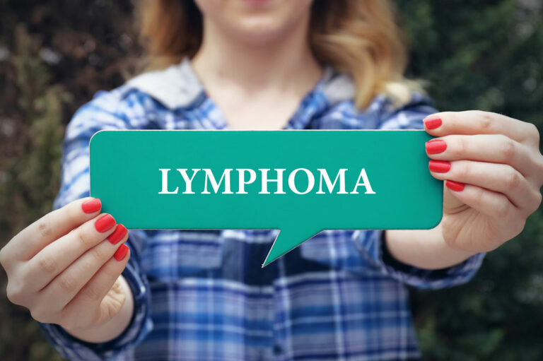 6 Factors That Contribute to the Risk of Developing Lymphoma