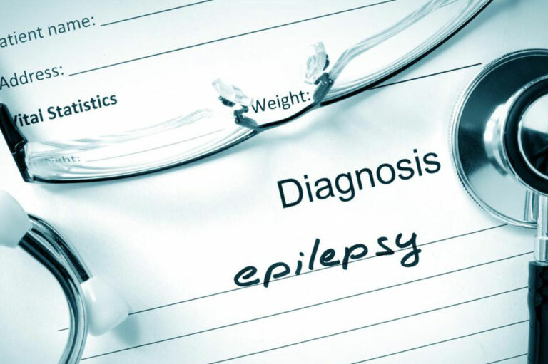 6 Must Try Epilepsy Treatments for Prolonged Relief