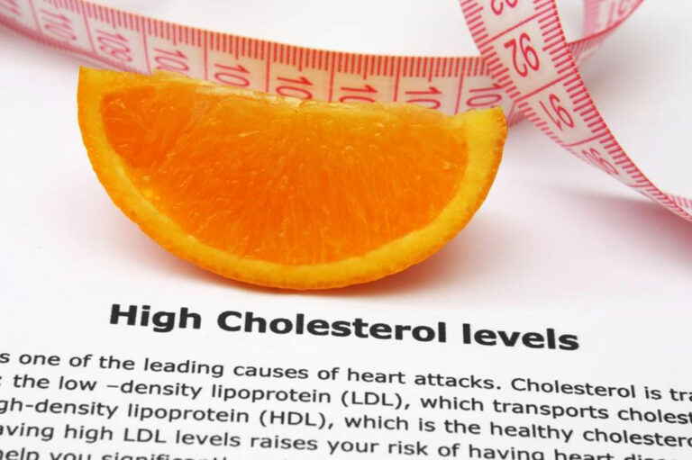 6 Self-Management Tips for High Cholesterol Treatment