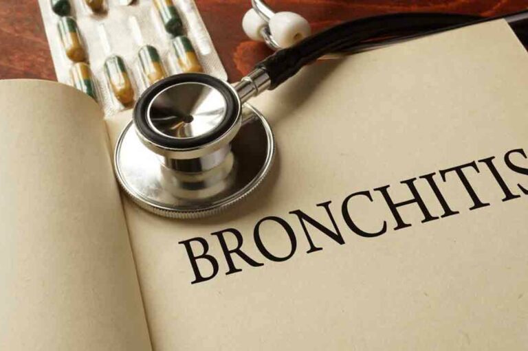 7 Methods for Treating Chronic Bronchitis