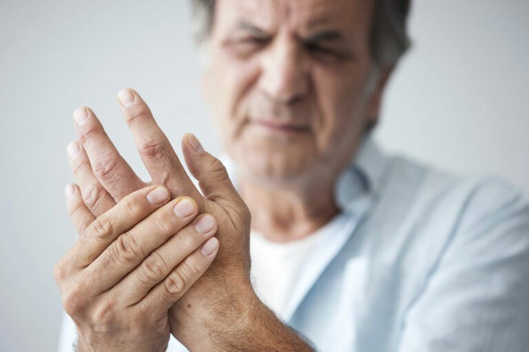 7 interesting facts about arthritis